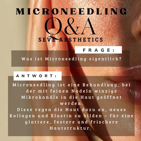 Microneedling Q&A von Seve Aesthetics